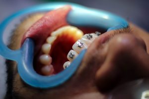 soins d’orthodontie